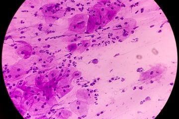 HPV Nedir?